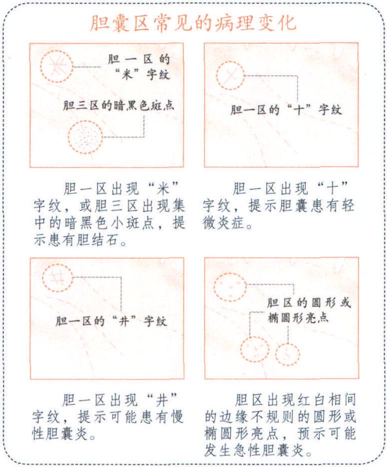 手掌上的膽囊區(qū)